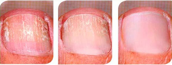 before-after